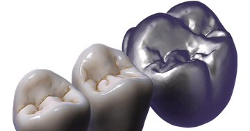 exocad TruSmile (Perpetual Initial Purchase)